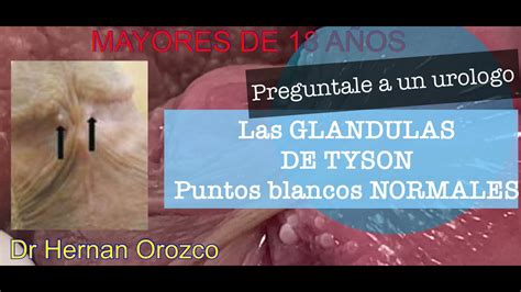 que son glandulas de tyson|Glándulas de Tyson